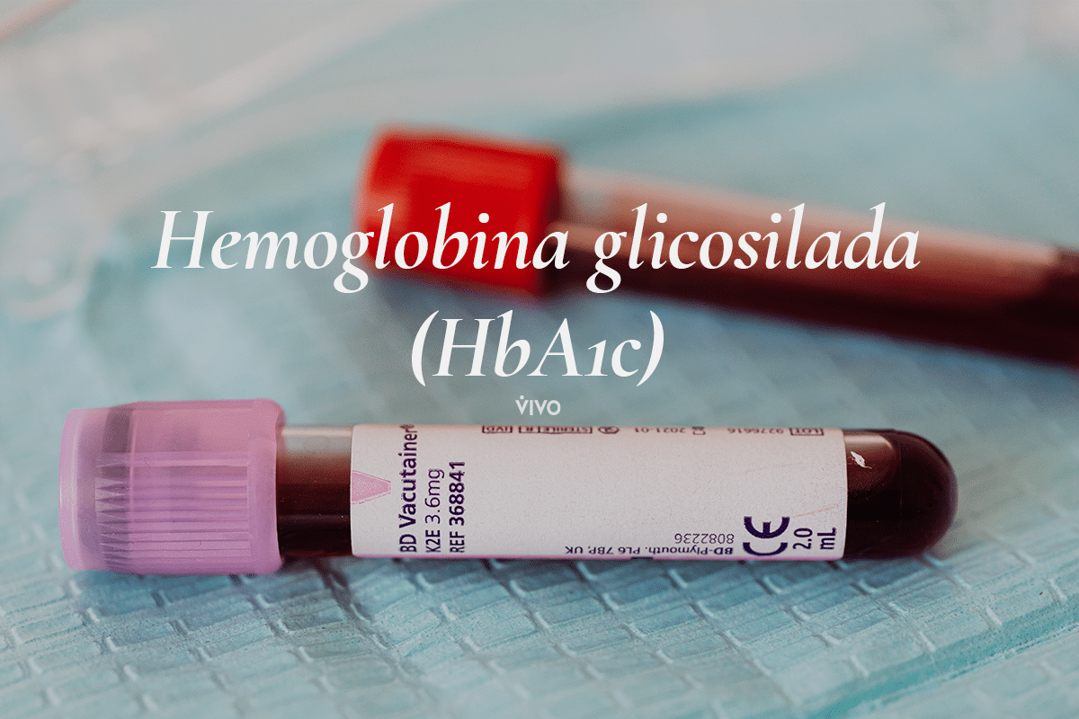 Hemoglobina Glicosilada Hba C
