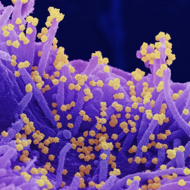 Compra tu prueba de candidiasis, en VIVOLABS. Causas, síntomas y tratamiento de esta enfermedad.