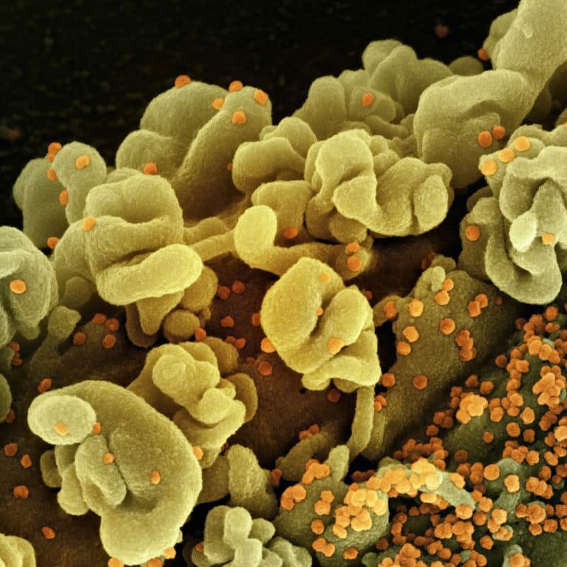 Causas, síntomas y tratamiento de la hepatitis B. Compra tu prueba en VIVOLABS.
