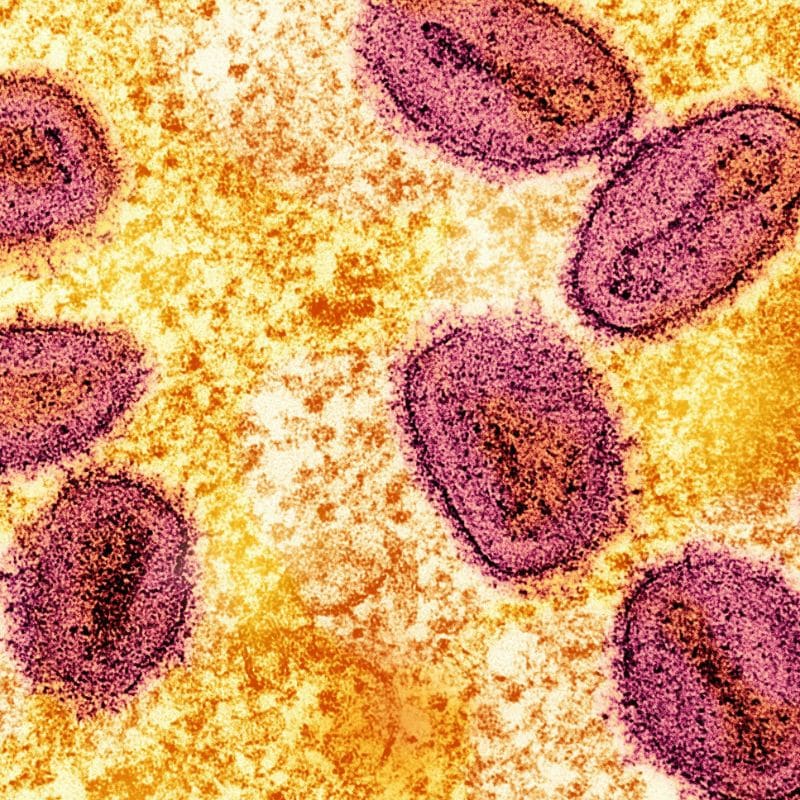 Compra tu prueba de tricomoniasis, en VIVOLABS. Causas, síntomas y tratamiento.