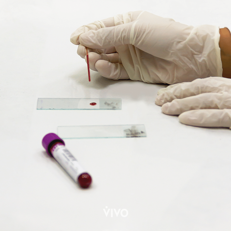 Muchas pruebas pueden detectar la anemia. 