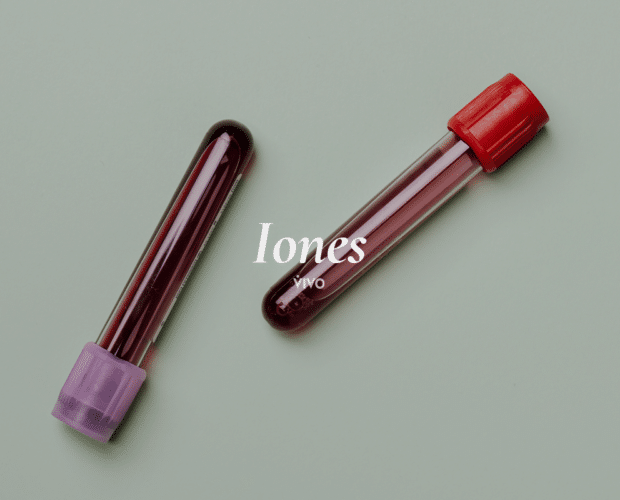 Iones