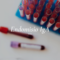 Una prueba de endomisio IgA