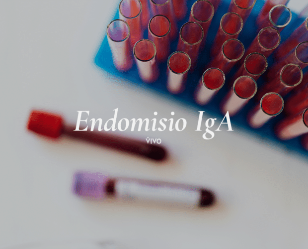 Una prueba de endomisio IgA
