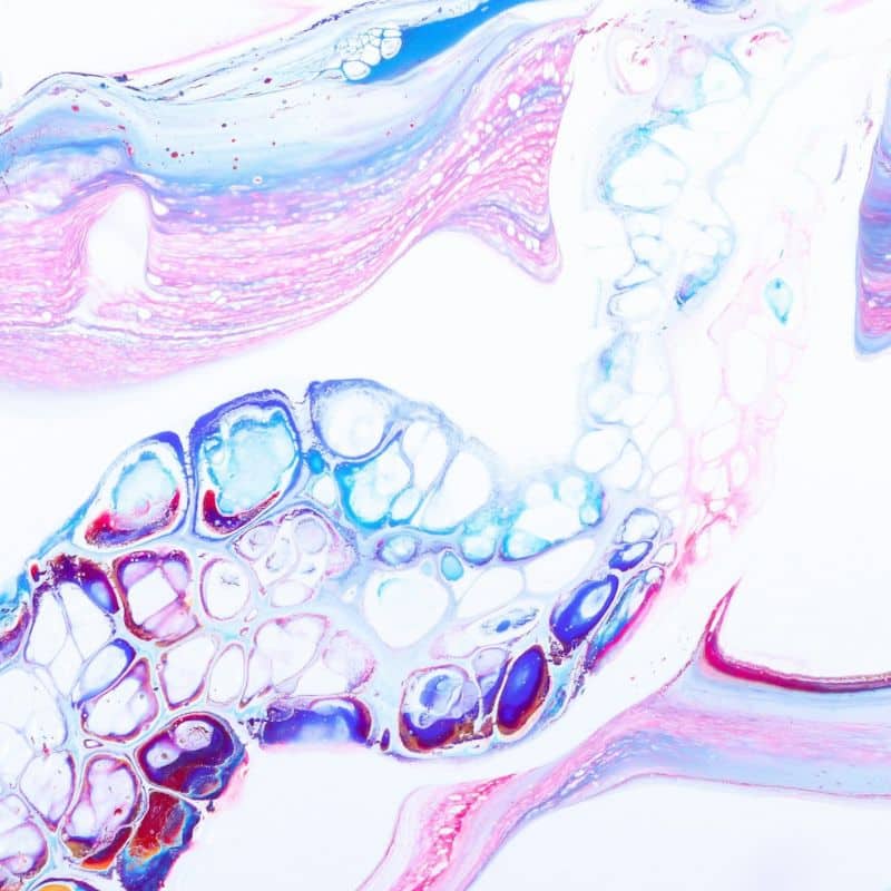 Tu estudio de cáncer de próstata y otros tipos de cáncer, en VIVOLABS.