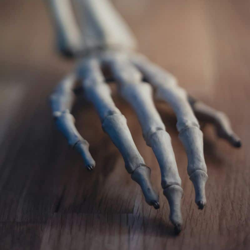 Osteoporosis, causas, síntomas y tratamiento.