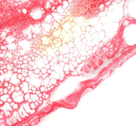riesgo cardio vascular genetico