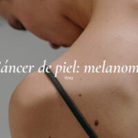 El melanoma es uno de los tipos de cáncer de piel más graves.