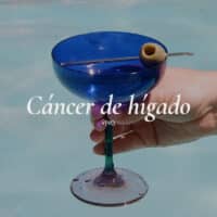 El alcoholismo es un claro factor de riesgo para el desarrollo de cáncer de hígado.