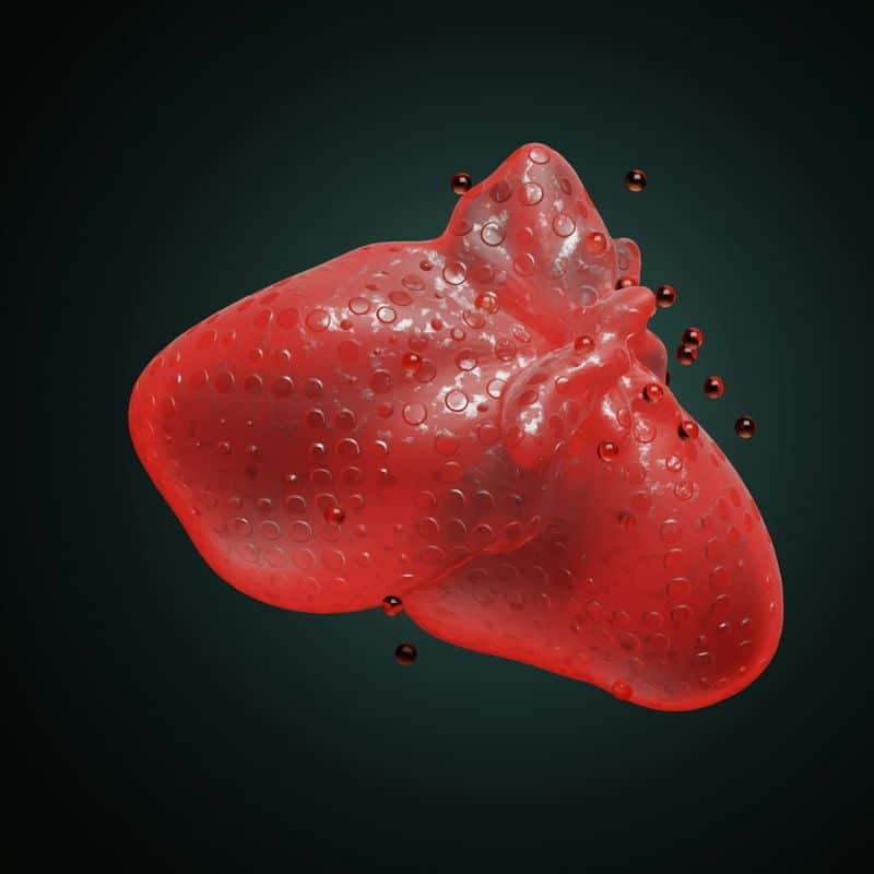 Cirrosis hepática: causas, síntomas y tratamiento.