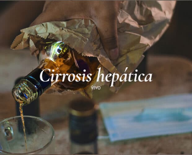 La cirrosis hepática puede tener muchas causas.