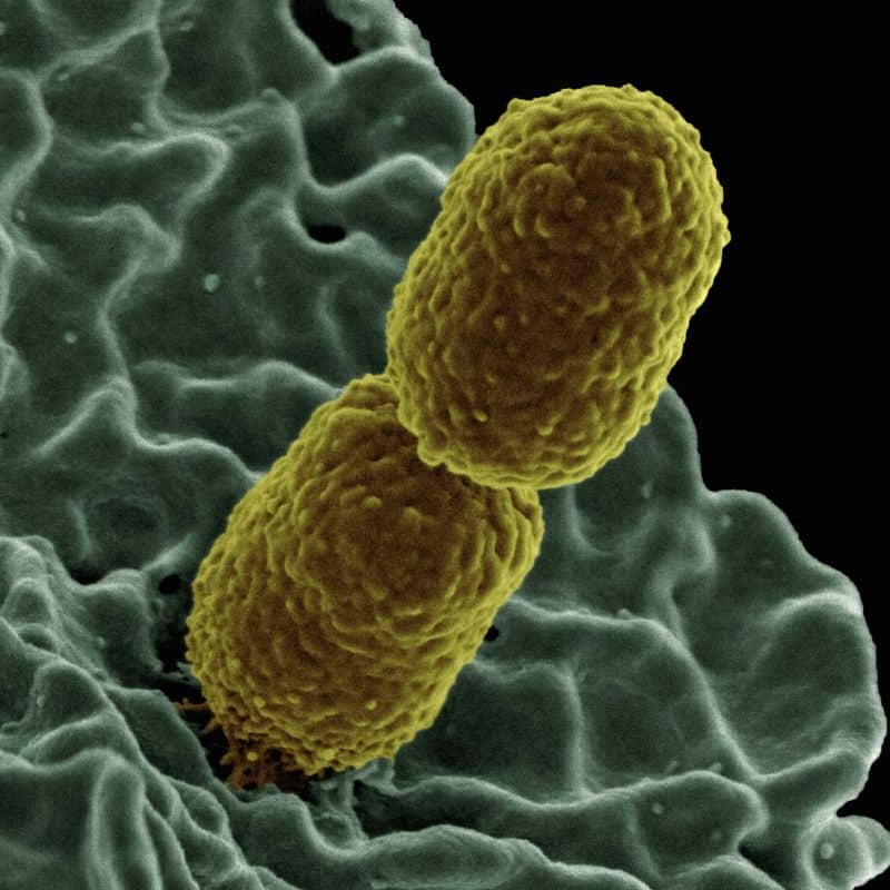 Bacteriuria asintomática, causas, síntomas y tratamiento.