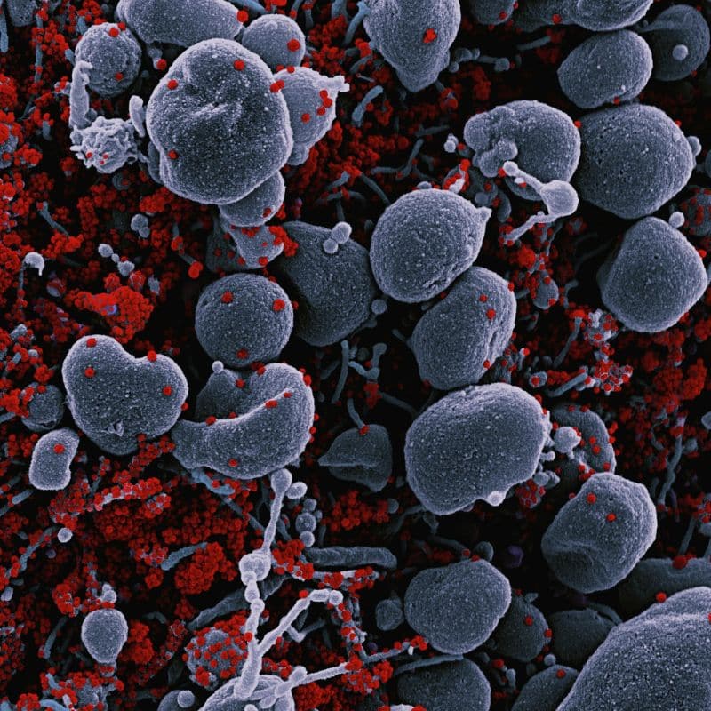 Disbiosis intestinal: ¿en qué consiste?