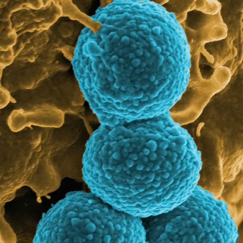 Estudio de microbioma: ¿qué es y para qué sirve?