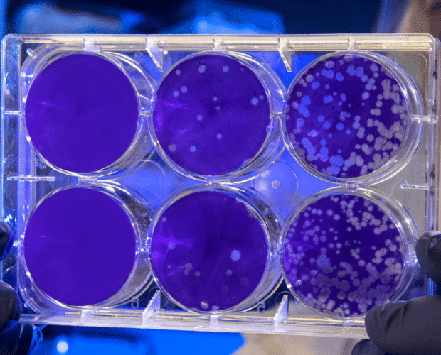 El microbioma reflejado en placas de cultivo.