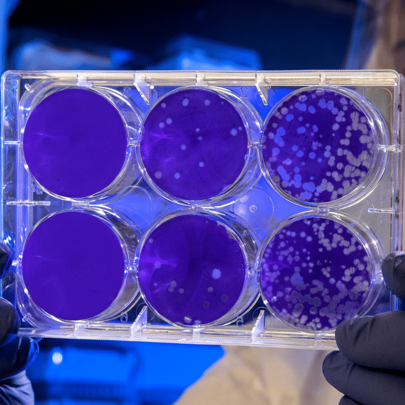 El microbioma reflejado en placas de cultivo.