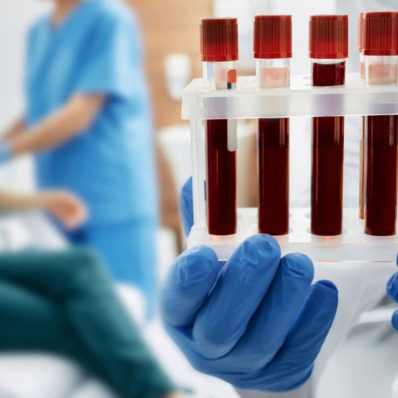 ¿Qué es un hemocultivo?