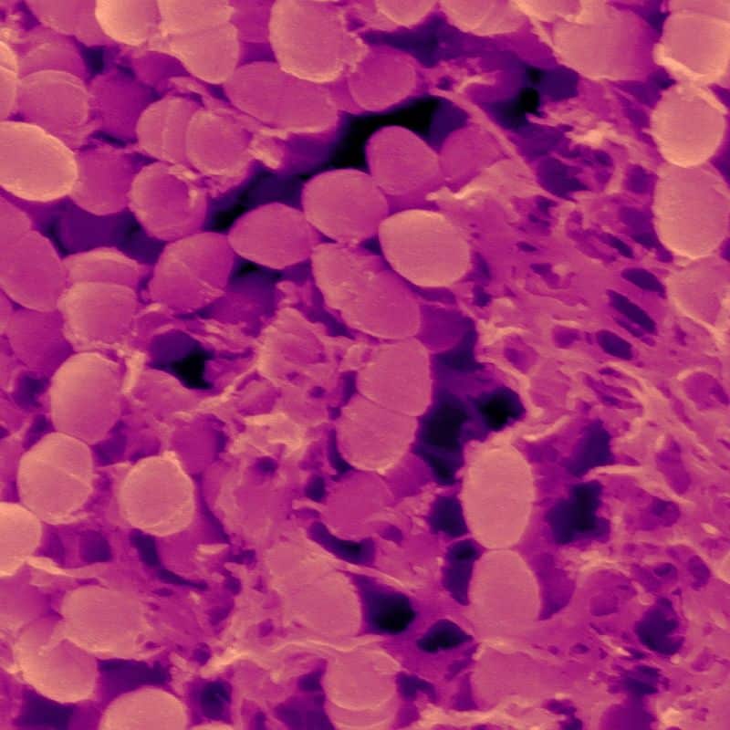 Microbiota y obesidad: ¿están relacionadas?