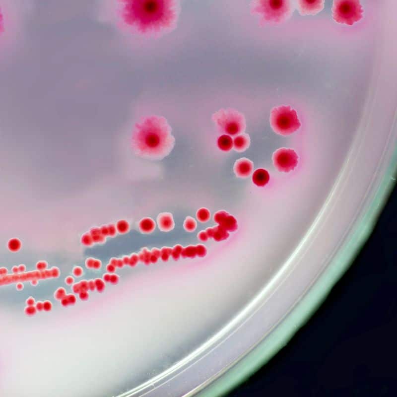 Microbiota vaginal: ¿qué es?