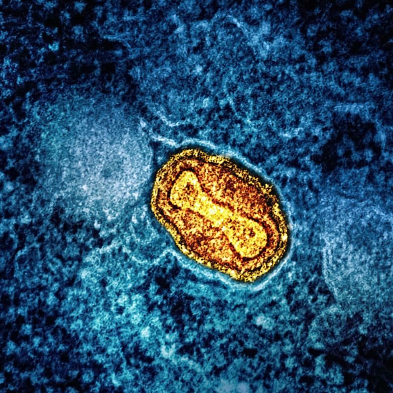 Prueba de gonorrea: tipos y procedimiento.