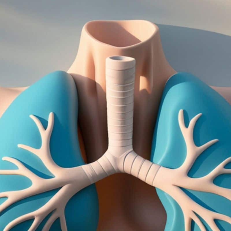 Cáncer de tráquea: causas, síntomas y tratamiento.