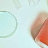 Sangre en la orina o hematuria: ¿cuáles son sus causas?