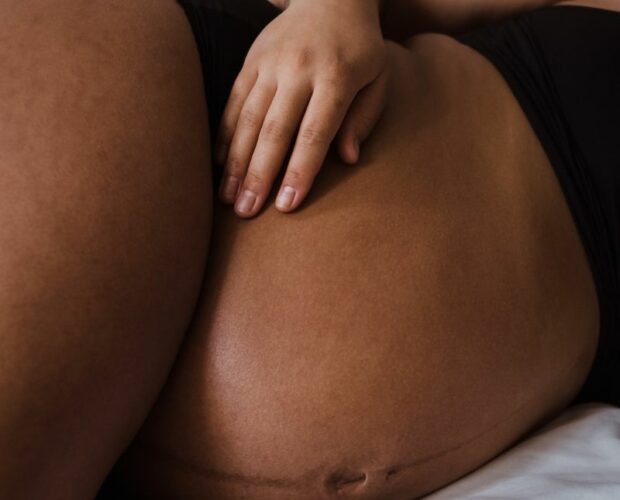 ¿Cómo se relacionan el embarazo y la enfermedad celiaca?