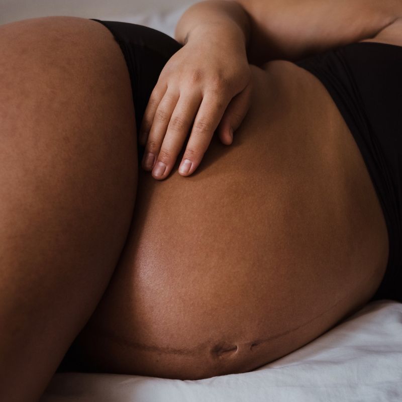 ¿Cómo se relacionan el embarazo y la enfermedad celiaca?
