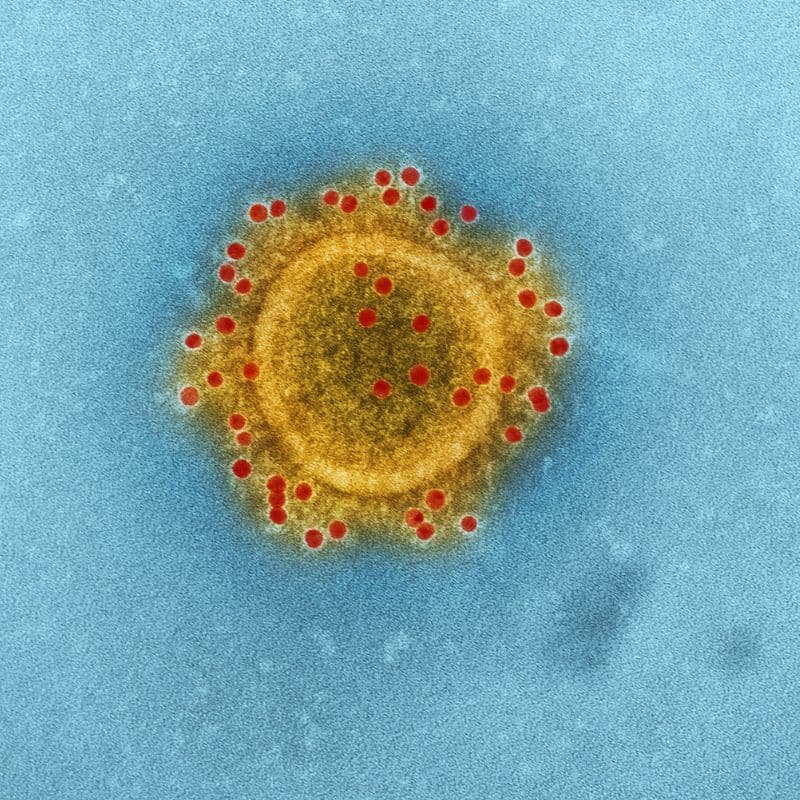 ¿Cuáles son las enfermedades infecciosas más comunes?