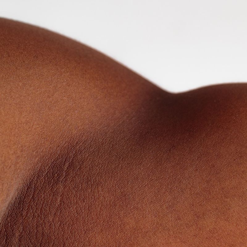 ¿Sabes cuáles son los tipos de cáncer de piel?