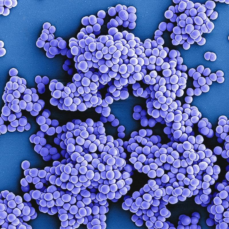 Giardiasis: causas, síntomas y tratamiento.