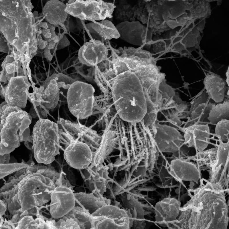 Shigelosis: causas, sintomas y tratamiento.