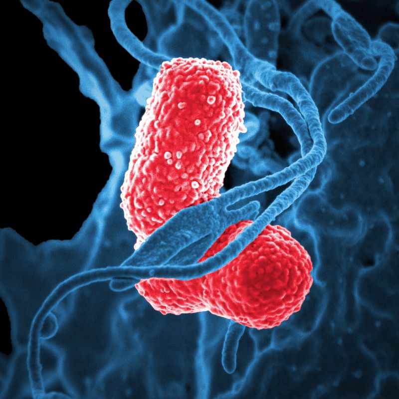 Test de aliento para el sobrecrecimiento bacteriano del intestino delgado (SIBO).