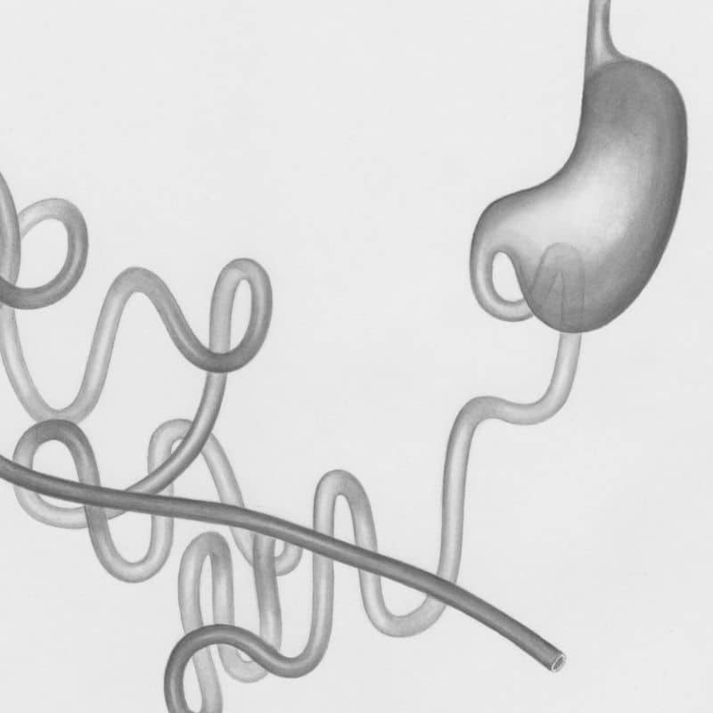 Los 10 tipos de colitis: cuáles son.