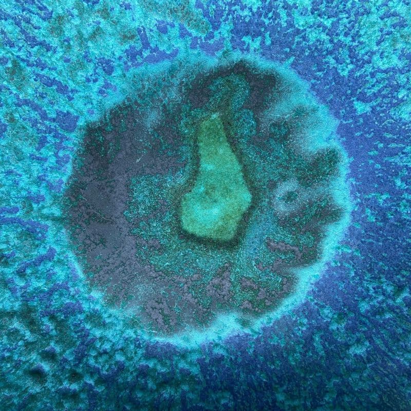 Amebiasis: causas, síntomas y tratamiento.