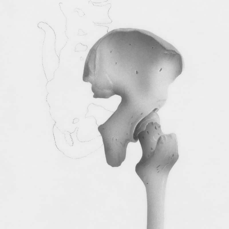Enfermedad inflamatoria pélvica: causas, síntomas y tratamiento.