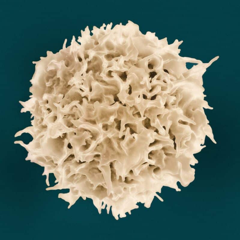 Estadísticas del cáncer de colon.