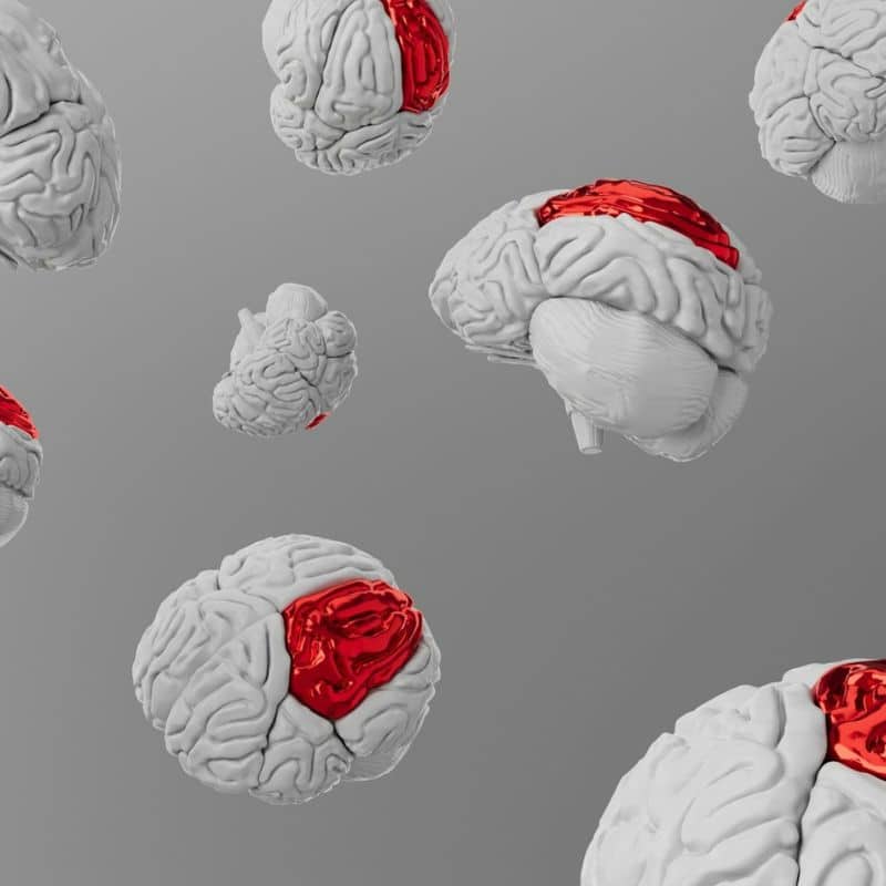 Estudio Completo de Déficit de DAO - Genética y Actividad DAO