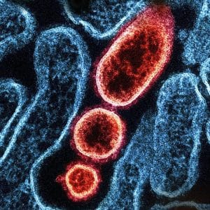 Compra tu estudio de microbiota y disbiosis oral, en VIVOLABS.