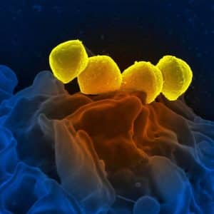 Comprar estudio de disbiosis vaginal, en VIVOLABS, al mejor precio.