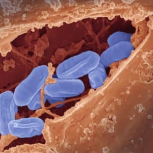 Compra tu estudio esencial de microbiota y disbiosis.