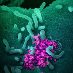 Compra tu estudio de sobrecrecimiento fúngico intestinal (SIFO), al mejor precio.