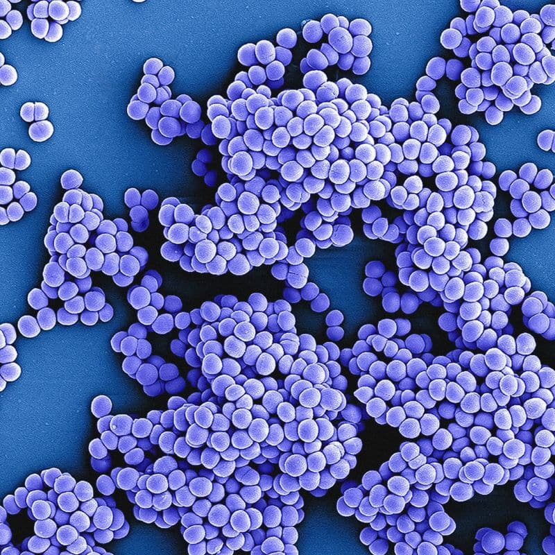 Estudios de microbiota al mejor precio, en VIVOLABS.