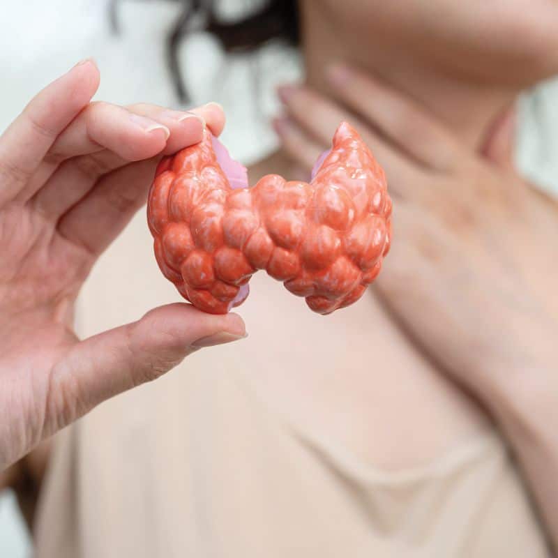 Perfil Hipotiroidismo - Hipertiroidismo