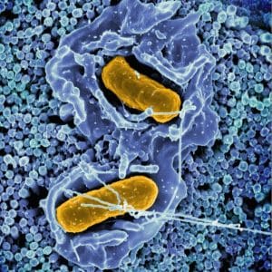 Compra tu test de aliento para la detección de Helicobacter pylori, al mejor precio.