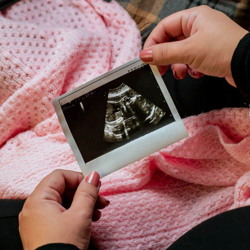 Test de Compatibilidad Inmunológica en Embarazo: KIR y HLA-C – Madre