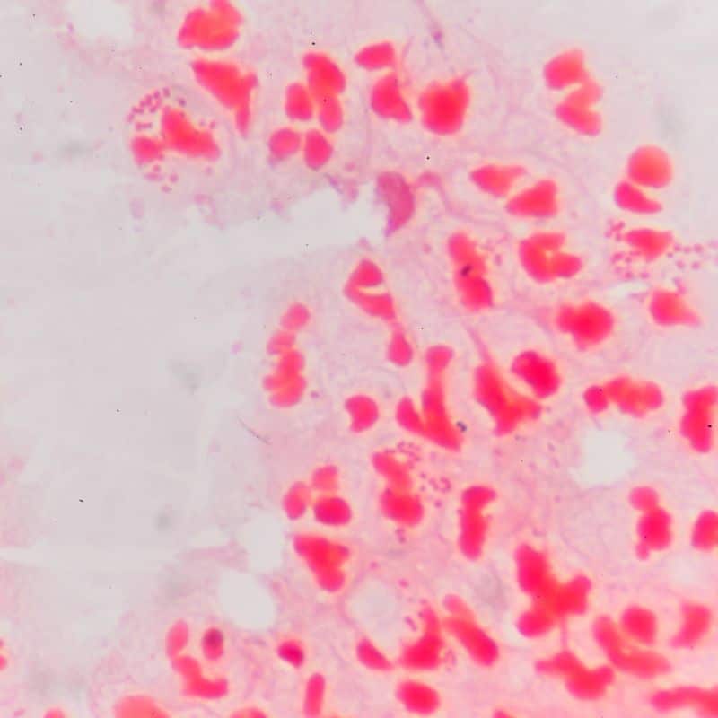 Chequeo completo de ETS e ITS: en qué consiste.