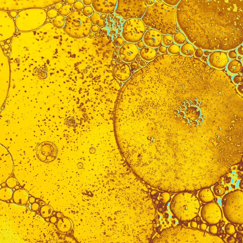 ¿Cuál es el nivel normal de colesterol en sangre?