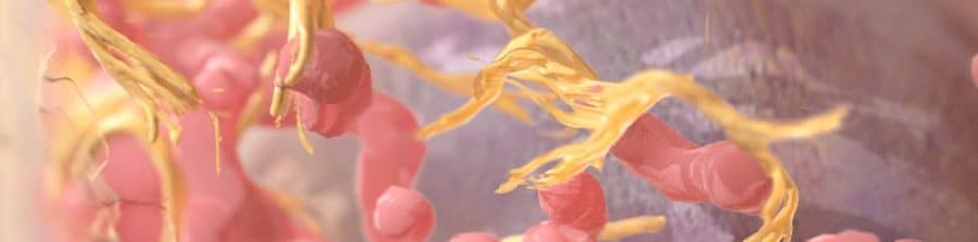 Estudio genético de cáncer hereditario de próstata.