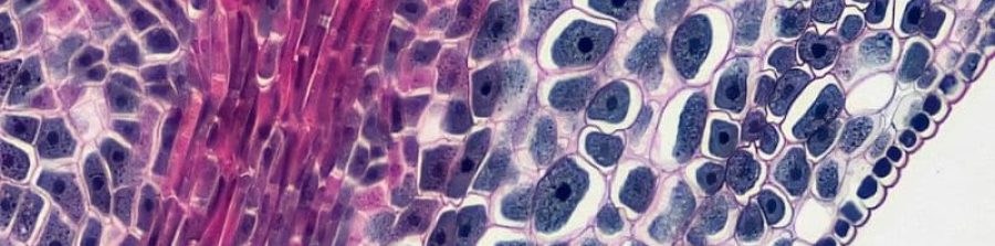 Estudio para la detección temprana de cáncer colorrectal.